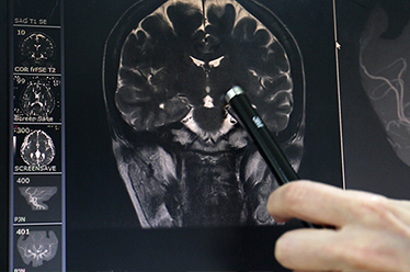 뇌MRI 검사 및 임상진단